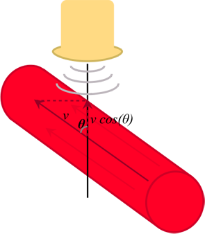 Doppler angle