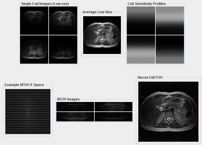 Parallel Imaging Simulation