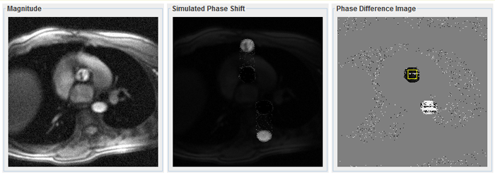 Phase Contrast Simulation