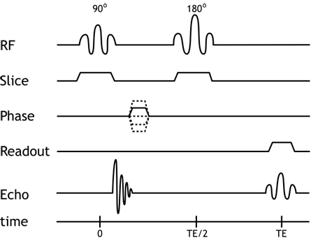 Spin echo pulse diagram