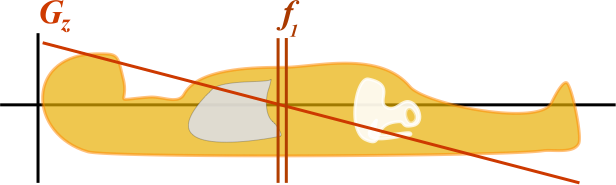 Slice-Select Gradient